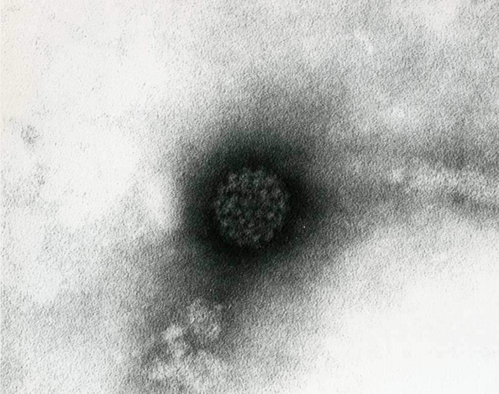 Wart virus
